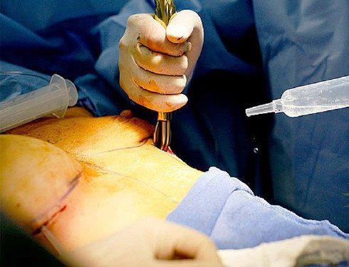 529644_401291096594859_17294428_n