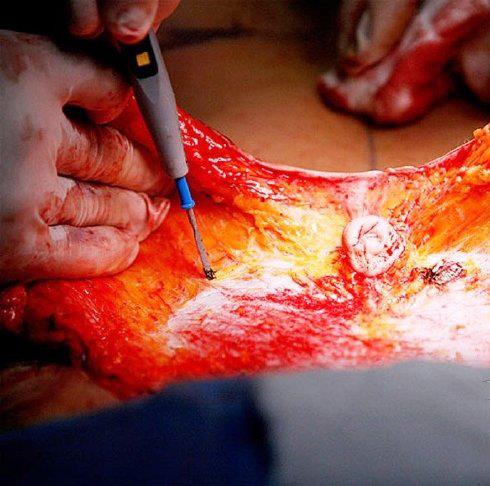 534765_401291216594847_665806811_n