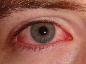 dd380678-03e0-4fc1-a8c5-2a143ace56e1_S_secvpf