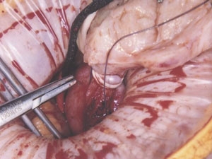 b5a2e8d8-0173-4389-8c77-28568cb5ee93_S_secvpf