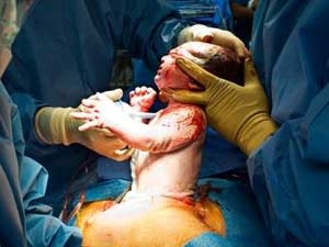 3a67edd3-9ce3-4657-b9e9-71f90188aaee_S_secvpf