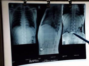 221f6344-1141-4814-8e68-6493718499d2_S_secvpf