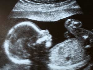 76466241-56d3-40d7-a316-c1f16e306ba0_S_secvpf