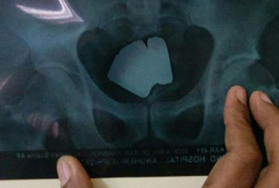 117691218096495533960-L