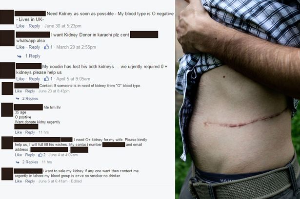 15643892221043975376KIDNEY