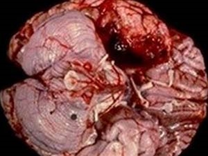 24cf0d7a-53b5-4b4b-a805-2963224d8892_S_secvpf