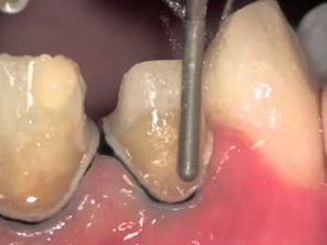 7c61e280-a623-486e-afad-7687b2adcb03_S_secvpf