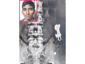 ea3dc405-c223-4161-8b91-85783ad682fc_S_secvpf