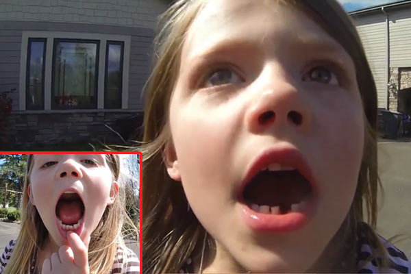 13760GRAB--Dad-uses-drone-to-pull-out-daughters-wobbly-tooth3