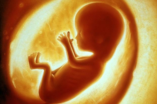 2034db32-481f-11e4-_777445c