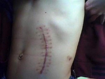 12552524_996292663776424_7688507056872685582_n