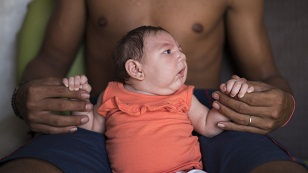 In this Dec. 23, 2015 photo, Dejailson Arruda holds his daughter Luiza at their house in Santa Cruz do Capibaribe, Pernambuco state, Brazil. Luiza was born in October with a rare condition, known as microcephaly. Luiza's mother Angelica Pereira was infected with the Zika virus after a mosquito bite. Brazilian health authorities are convinced that Luiza's condition is related to the Zika virus that infected her mother during pregnancy. (AP Photo/Felipe Dana)
