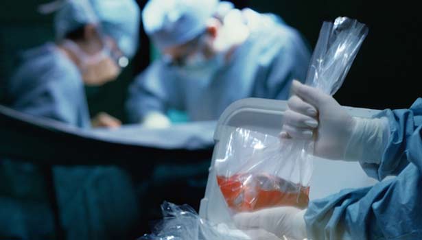 201604021553562727_Providing-donated-organs-in-China-wasted_SECVPF