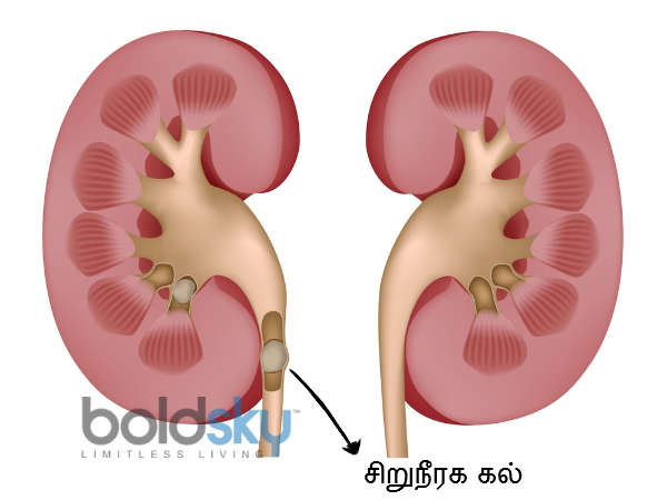 04-1467631469-3cucumberjuicewithgingermintandapplepreventsyoufromkidneystones