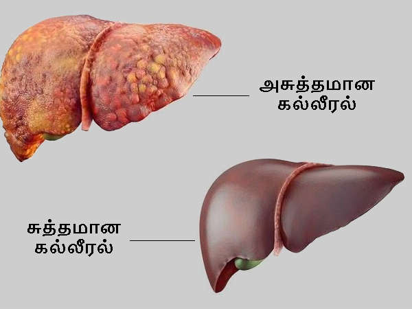 1-liver-detox-21-1466486795