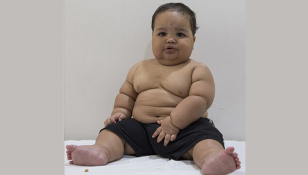 201607061122560547_18-month-old-boy-suffers-from-rare-disorder-weighs-22-kgs_SECVPF
