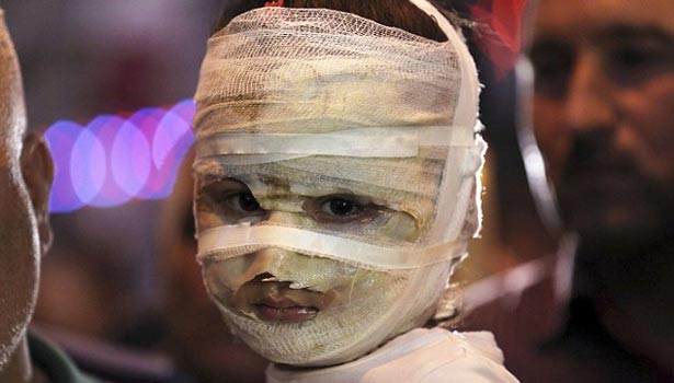 201607141720228419_four-year-old-girl-returned-to-the-bomb-site-for-a-candlelit_SECVPF