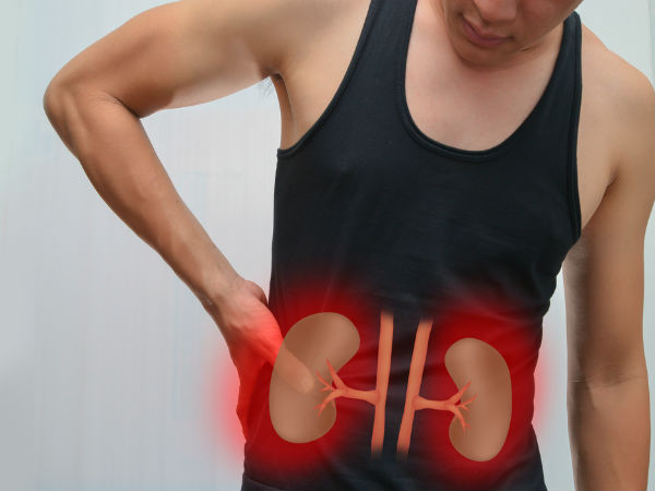 kidney-15-1468579478