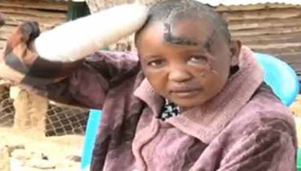 201608031604273325_women-attacked-in-Kenya-for-not-delivering-child-for-7-years_SECVPF