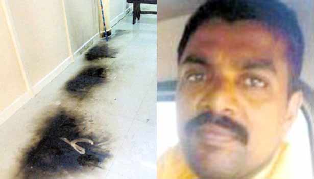 201609071006101901_Operation-delay-to-patient-self-immolation-in_SECVPF