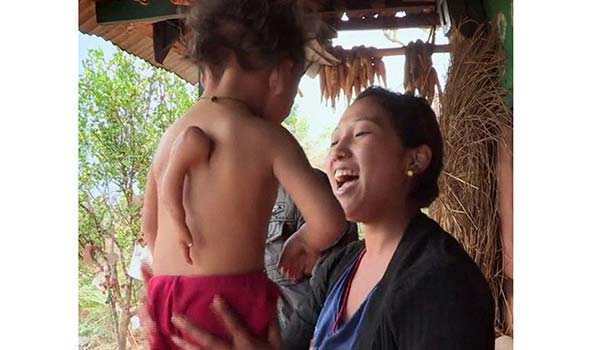 201610181125392825_boy-lives-3-arm-in-nepal_secvpf