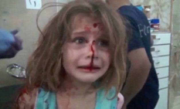 blood_child_syria_001-w245