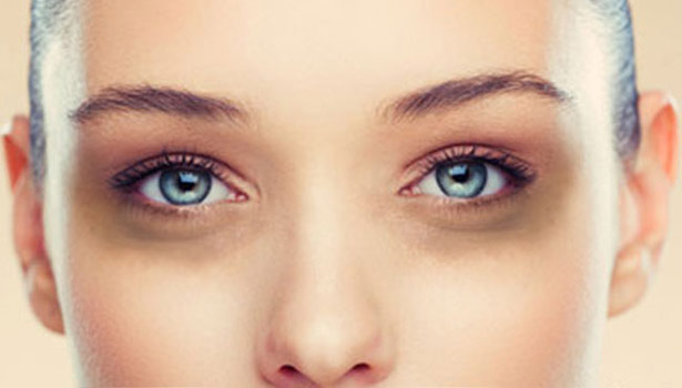 201611030902240094_black-circles-under-eyes-reason-and-solution_secvpf-gif