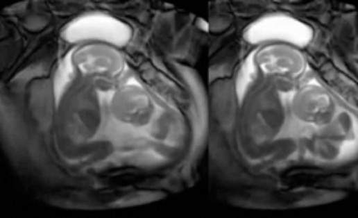 twins_fight_001-w245