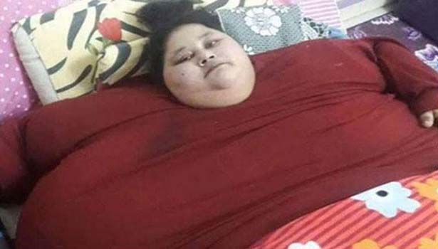 201612101313477323_weight-loss-surgery-egyptian-woman-fly-to-india_secvpf