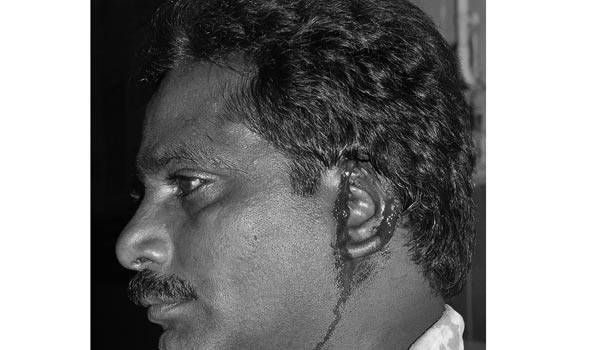 201612151733287650_temple-guardian-ear-cut-for-hostile-near-rasipuram_secvpf