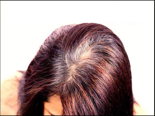 unique-tricks-to-get-rid-of-grey-hair-28-1482916505