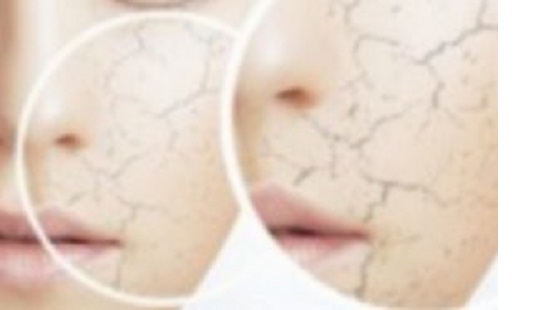 1482387398-1356-300x187