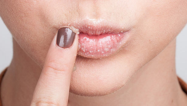 201612200822243337_ways-to-protect-your-lips-in-winter_secvpf