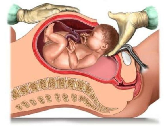 2b5ket3q800x480_image52200154-585x439