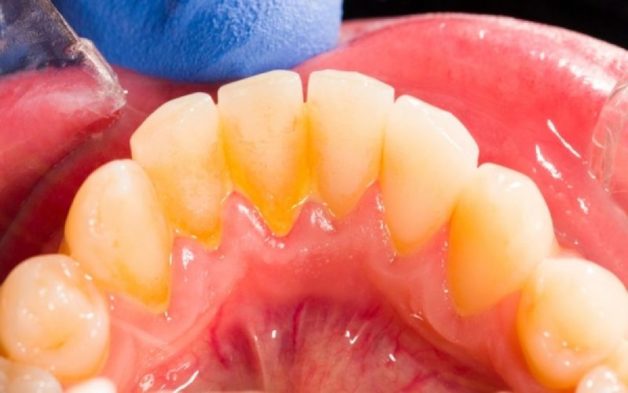 3cf88abd09dfaee9a24a8a640a8e2d29_xl