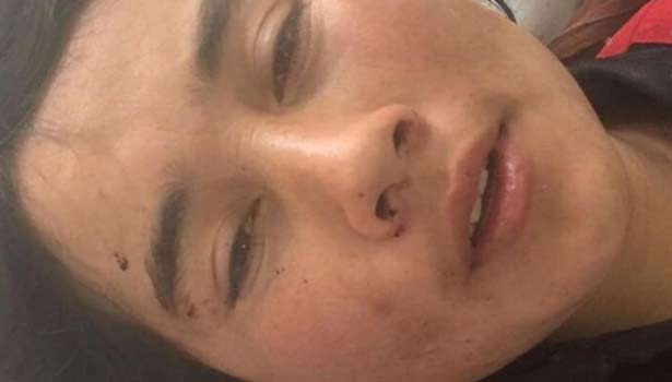 201702021338132957_Afghan-woman-has-ears-cut-off-by-suspicious-husband-in_SECVPF