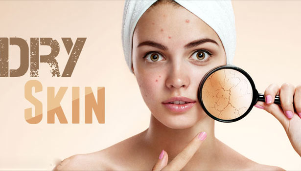 201702040934559710_dryness-of-the-skin-why_SECVPF