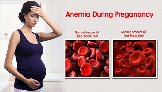 201702041202419521_anemia-during-pregnancy-affect-infant_SECVPF