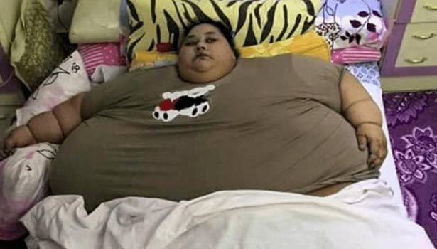 201702120554418869_Worlds-heaviest-woman-admitted-to-Saifee-Hospital-in-Mumbai_SECVPF