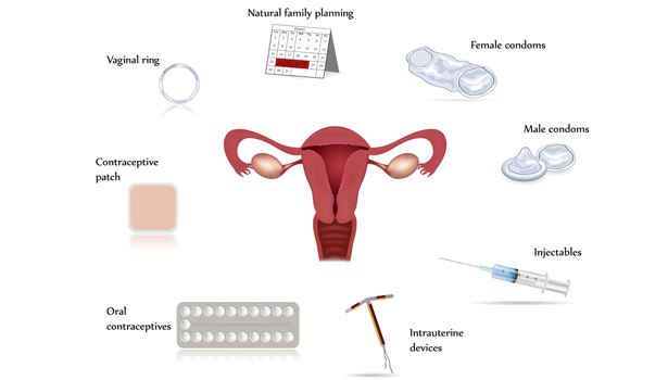 201702180931128191_Things-to-consider-before-putting-the-Copper-T_SECVPF