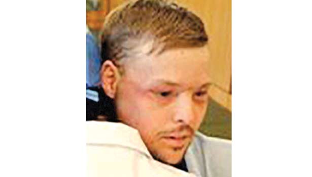 201702181312154740_Operation-organ-transplant-donor-through-the-other-person_SECVPF