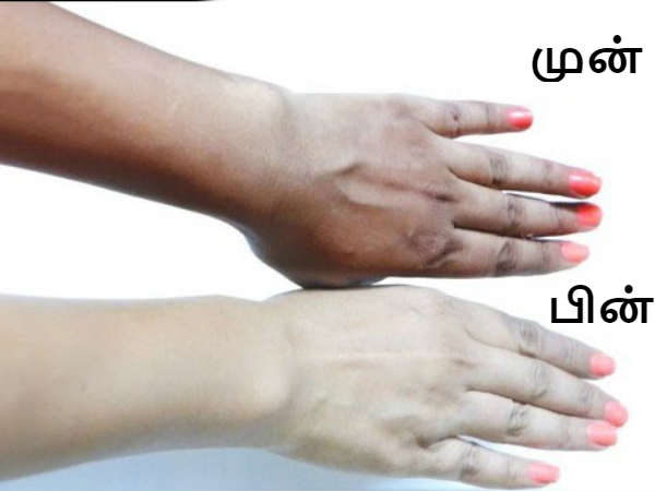 dark-fair-skin-09-1486624213