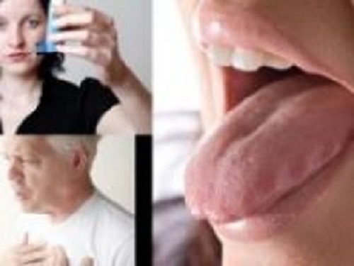 அதிகப்படியாக-நாக்கில்-எச்சில்-சுரந்தால்-இந்த-நோயா