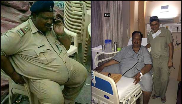 201703090421524474_fat-police-gets-free-treatment-after-he-was-trolled-in_SECVPF