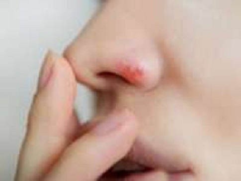 சளியால்-மூக்கு-ஓரமா-காயமாகி-இருக்கா-அதைப்-போக்க-இதோ-சில-வழிகள்