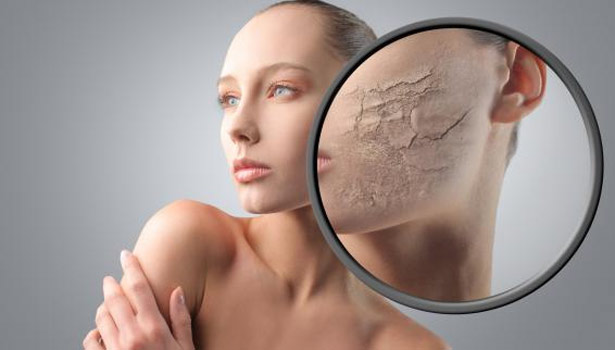 201704111337219006_summer-skin-dryness_SECVPF