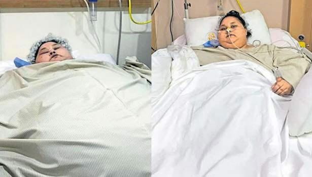 201704120326075185_Eman-Ahmed-lost-262-kg-since-arrival-in-Mumbai_SECVPF