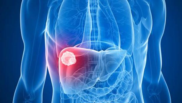 201704290805400102_Symptoms-of-liver-damage_SECVPF