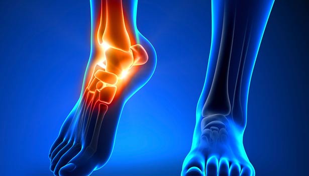 201705300831018577_Why-is-it-often-called-foot-pain-or-leg-pain_SECVPF