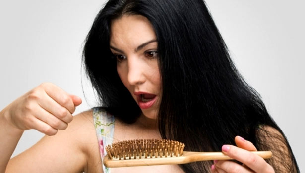 201705311134352738_hair-fall-Dandruff._L_styvpf